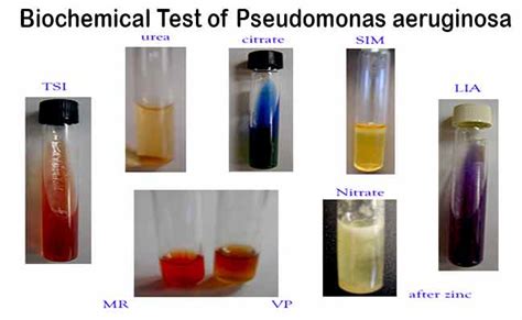 pseudomonas aeruginosa catalase test